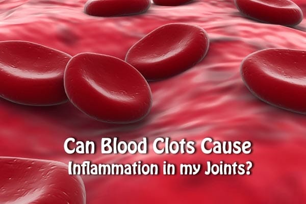 can-blood-clots-cause-inflammation-in-my-joints-respectcaregivers