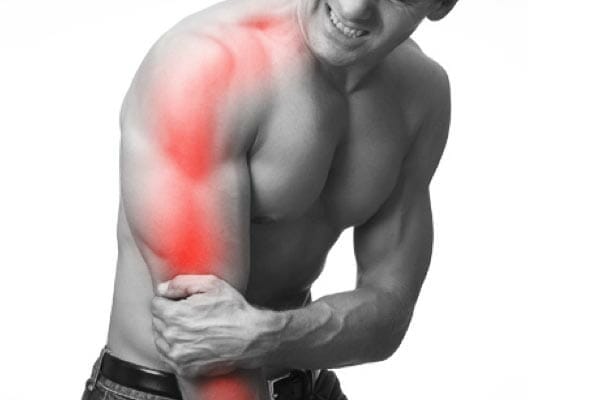 Cervical Radiculopathy