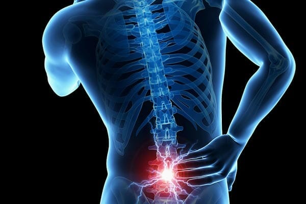 Do You Have Back Pain and Multiple Sclerosis?