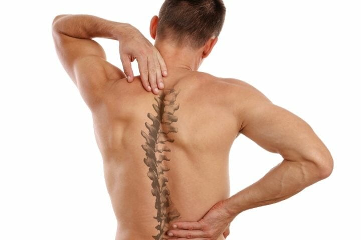 Can You Get Disability For Scoliosis