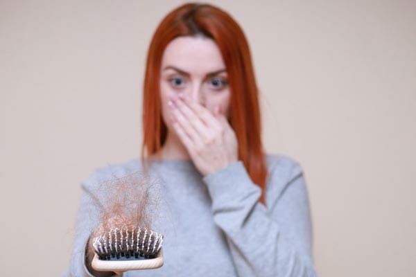 alopecia-areata-can-t-be-cured-but-it-can-be-prevented-respectcaregivers