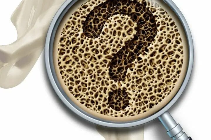 Dealing With Osteoporosis In Old Age