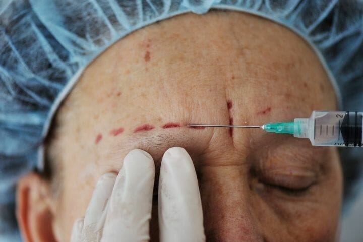 Cosmetic Surgery For Seniors – How Old Is Too Old?