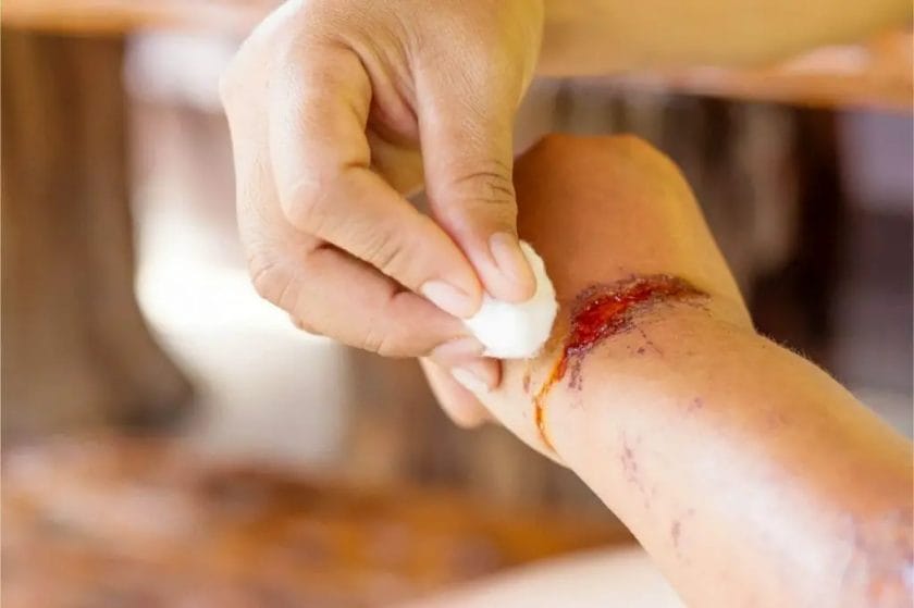 How to Care For Wounds for Elderly With Thin Skin