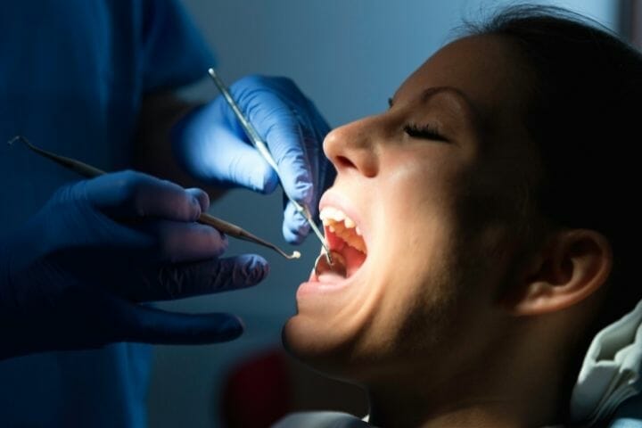 Dental Amalgam Fillings