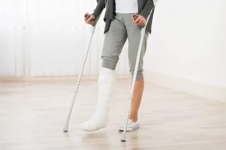 Man with leg cast and crutches