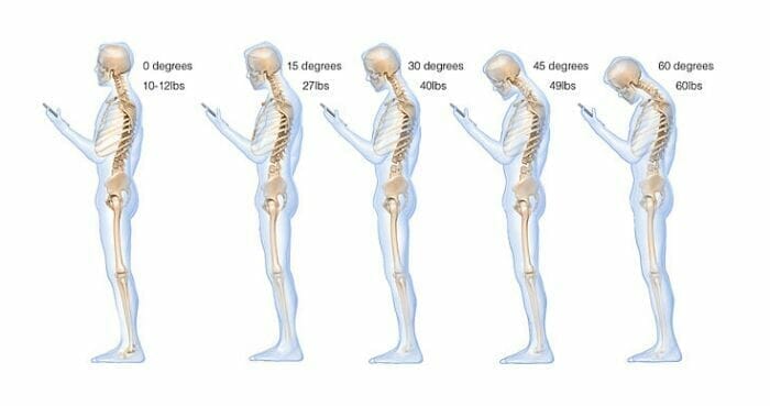 What mobile phone usage does to your spine