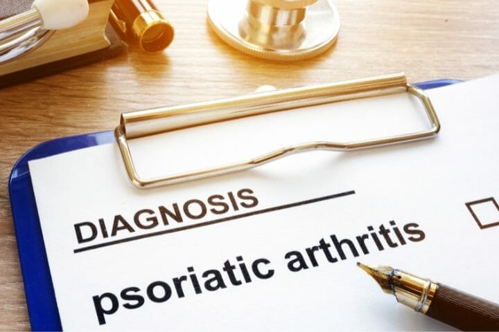 Can You Get Disability For Psoriatic Arthritis? - Respectcaregivers