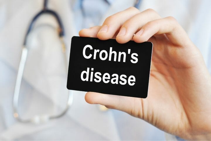 Can You Get Disability For Crohns Disease