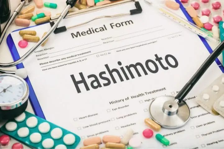 can-you-get-disability-for-hashimoto-s-disease-respectcaregivers