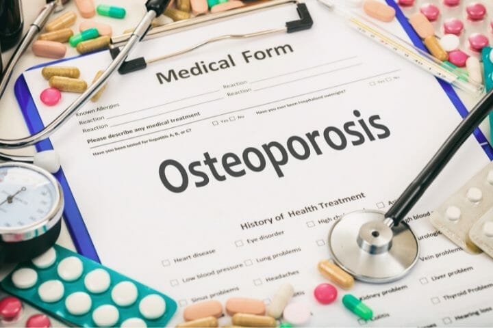Can You Get Disability For Osteoporosis