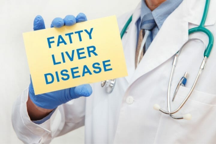 Can You Get Disability For Fatty Liver Disease