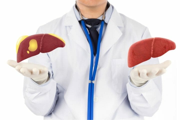 Can You Get Disability For Fatty Liver Disease