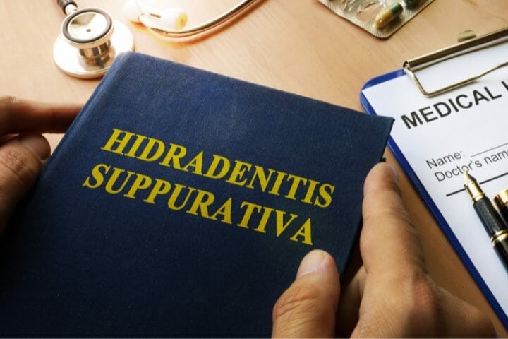 Can You Get Disability For Hidradenitis Suppurativa