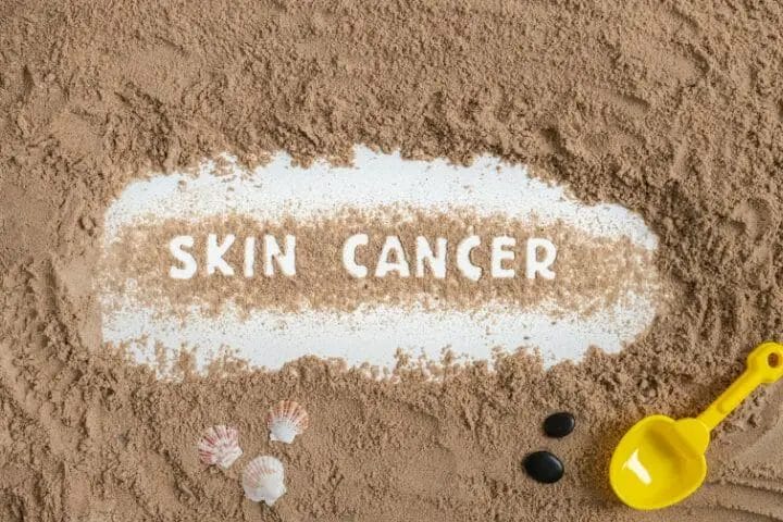 Can You Get Disability For Skin Cancer