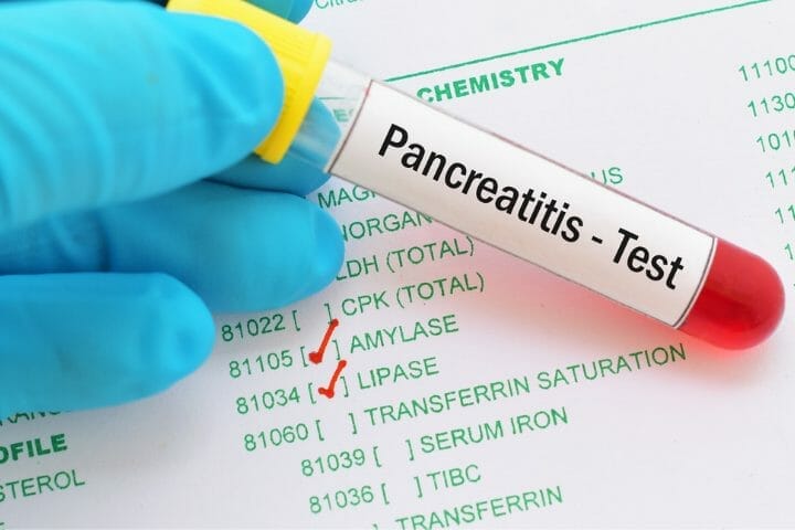 Can You Get Disability For Pancreatitis