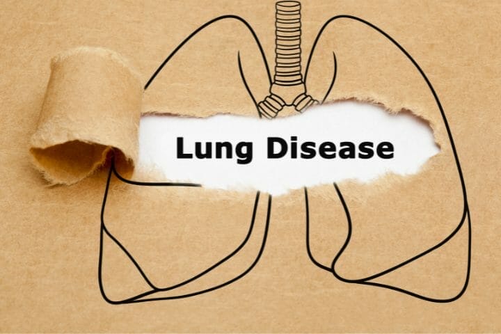 Can You Get Disability For Lung Disease