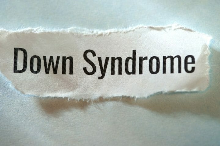 is-down-syndrome-an-intellectual-disability-respectcaregivers