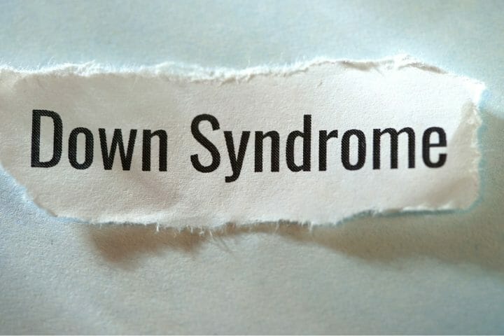 Is Down Syndrome An Intellectual Disability